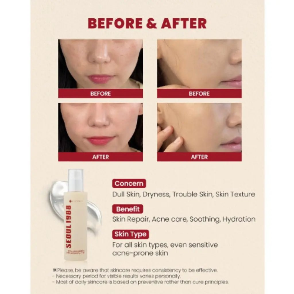 K-Secret - Seoul 1988 Essence: Snail Mucin 97 Percent + Rice 100ml