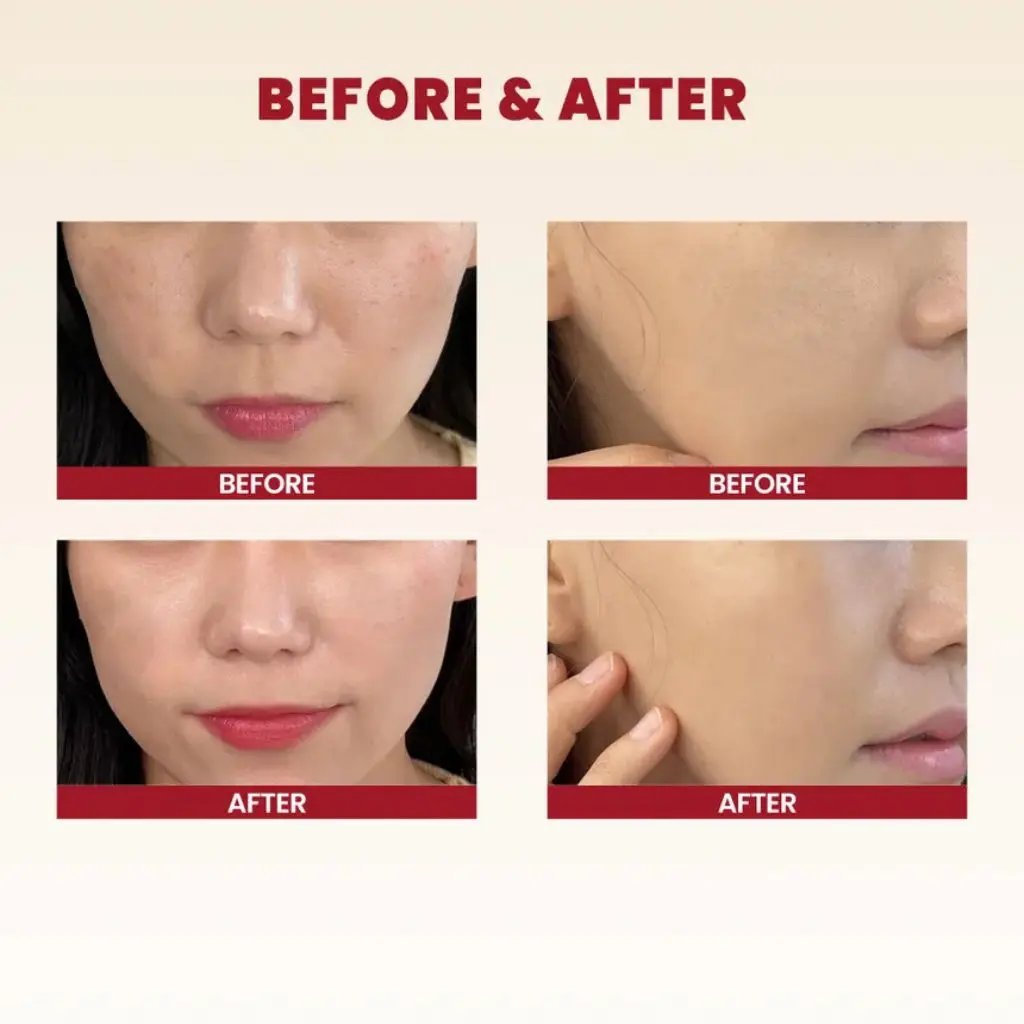 K-Secret - Seoul 1988 Cream: Snail Mucin 93 Percent + Rice 100ml