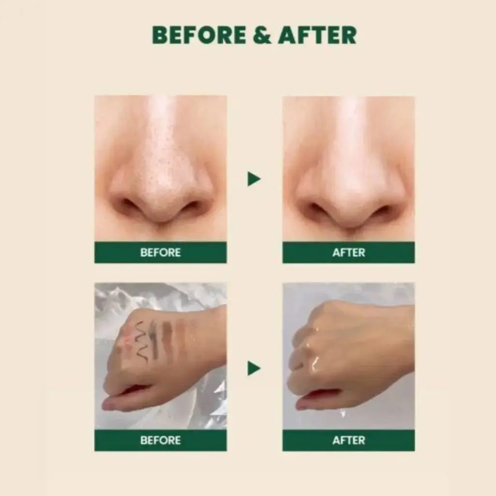 K-Secret - Seoul 1988 Cleansing Oil: Pine Cica 1% + Probiotics