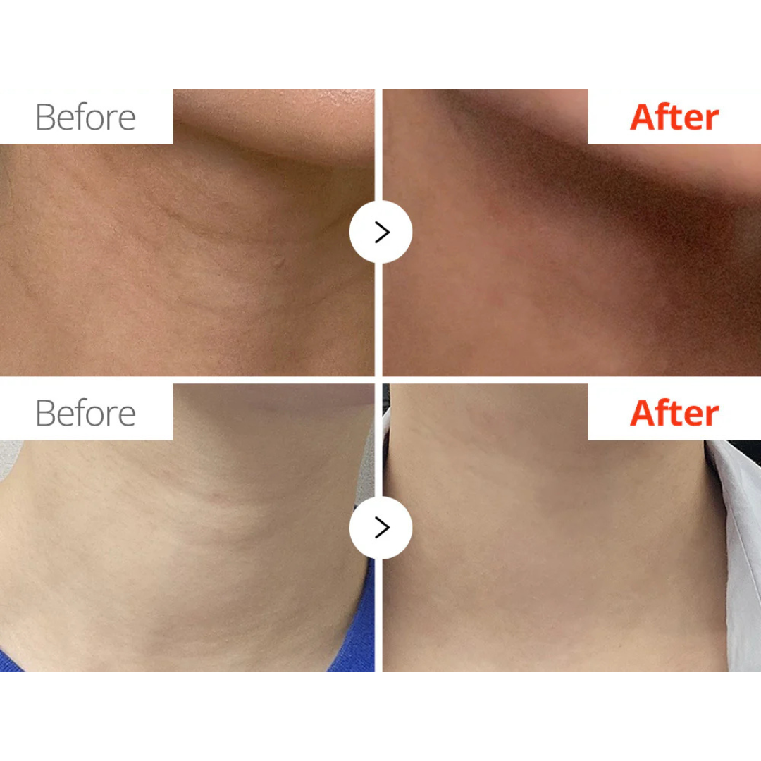 Necksphalt ECM Ceramide Neck Cream - 50 ml