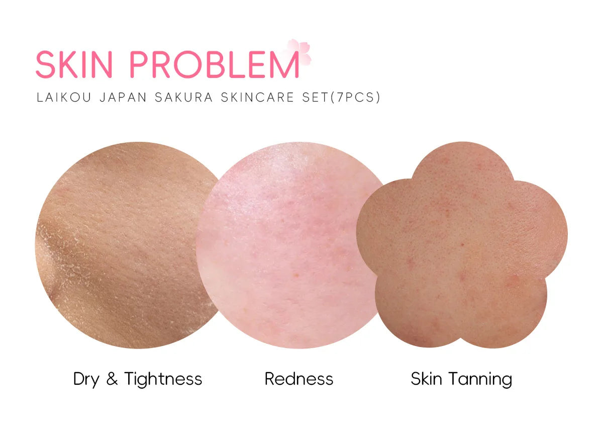 Sakura Skin Care Kit Hydrating Moisturizing Skin Care with Cleansing Pore Treatment and Sunscreen Cosmetic Skincare Korean