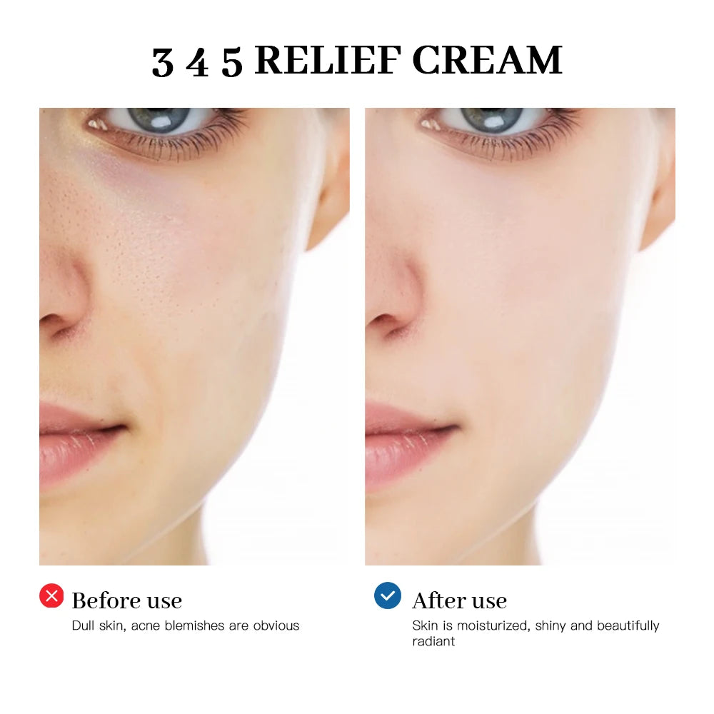 345 Relief Cream